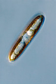 Diatom frustule,light micrograph