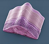 Diatom,SEM