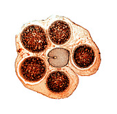 Liverwort spore cases,light micrograph