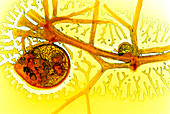 Bladderwort bladder,light micrograph