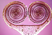 Cross-section of water lily bud