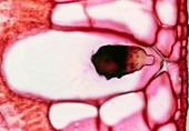 Lithocyst in a fig leaf cell