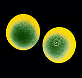 False-col SEM of two pollen grains
