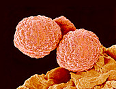 Common dewberry pollen,SEM