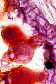 Pollen tube,light micrograph