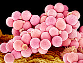 Primrose pollen,SEM