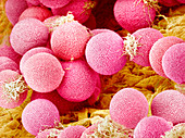 Primrose pollen,SEM