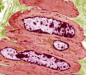 Intestinal smooth muscle cells,TEM