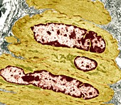 Intestinal smooth muscle cells,TEM