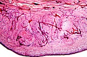 Ovary tissue,light micrograph