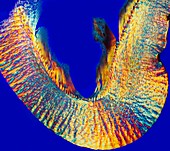 Sheep's hoof,light micrograph