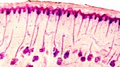 Skin sweat glands,light micrograph
