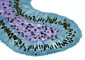 Gall bladder surface,light micrograph