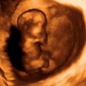 Foetus at 10 weeks,3D ultrasound