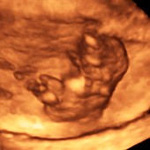 Foetus in the womb 3D ultrasound
