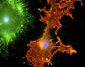 Brain cells in culture,light micrograph