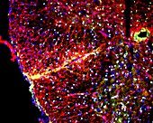 Nerve cell trauma response