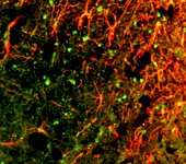 Nerve cell trauma response