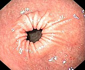 Peristalsis in the stomach