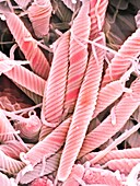 Helicobacter bilis bacteria,SEM