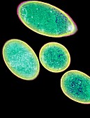 Clostridium difficile bacteria,TEM