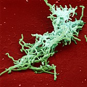 Lyme disease bacteria,SEM