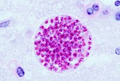 Toxoplasmosis parasite cyst