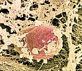 Osteoblast bone cell,SEM