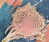 Bone marrow stem cell,SEM