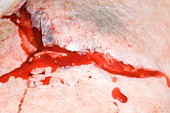 Shin wound