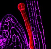 Plant embryo,light micrograph