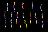 Human sex cell karyotype