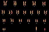 Mouse karyotype