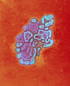 H1N1 1976 swine flu virus,TEM