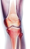 Normal knee,X-ray