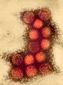 Changuinola virus,TEM