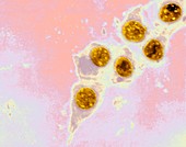 Chlamydia trachomatis bacteria,TEM