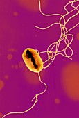 E. coli bacterium strain O157:H7,TEM