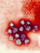 H5N3 influenza A virus particles,TEM