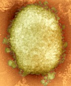 Monkeypox virus particle,TEM