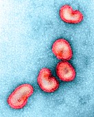 H1N1 Influenza A virus particles,TEM