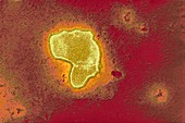 Respiratory syncytial virus particle,TEM