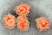 Human coronavirus,TEM