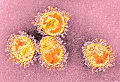 Human coronavirus,TEM