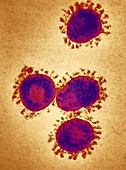Infectious bronchitis virus (IBV),TEM