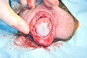 Scrotum surgery
