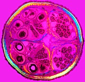 Fern spore capsule,light micrograph