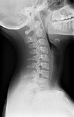 'Healthy spine of the neck,X-ray'