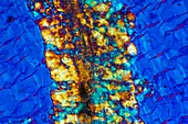Inulin crystals,light micrograph