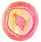 Oleander stem,light micrograph